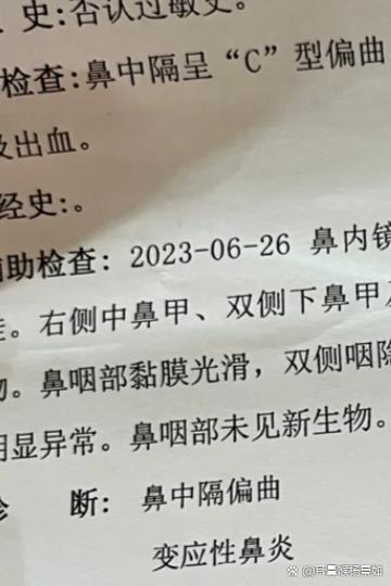 右流鼻血是什么原因引起的呢?