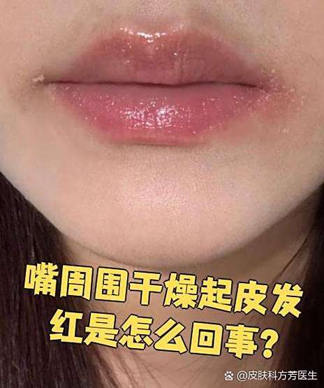 嘴皮污是怎么回事