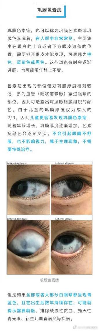 眼睛看到红色和蓝色的小点点