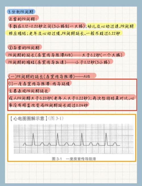 pr间期延长严重吗