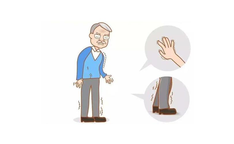 运动迟缓是什么症状