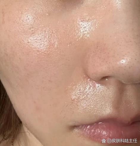 用盐洗脸有什么好处截图3