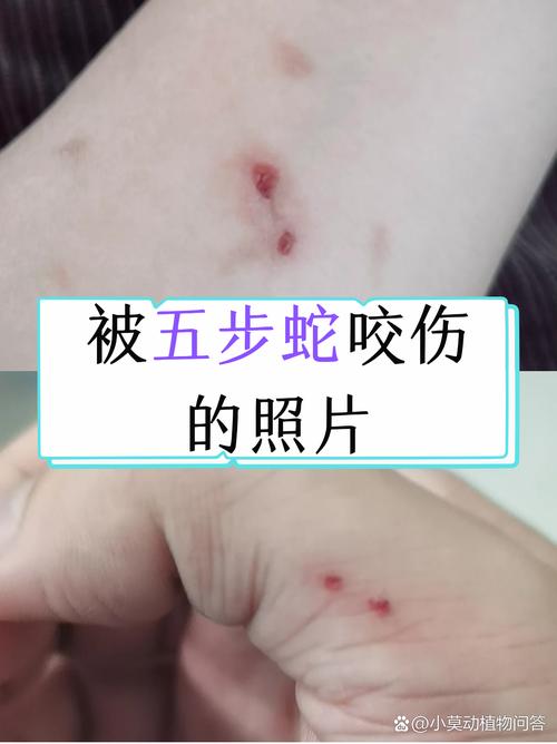 51昆咬短视频