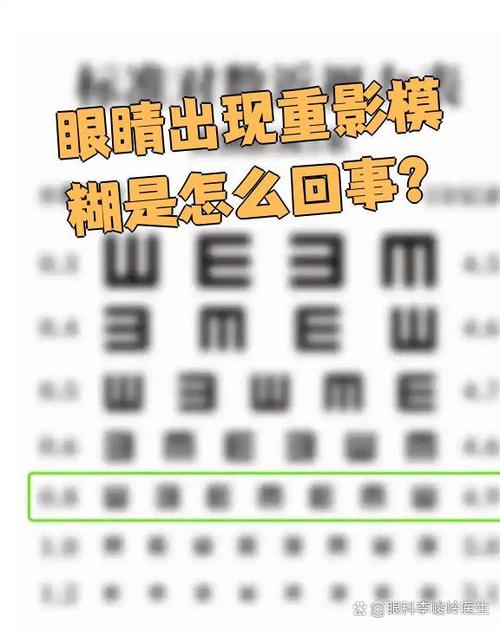 眼睛视力模糊什么原因造成的