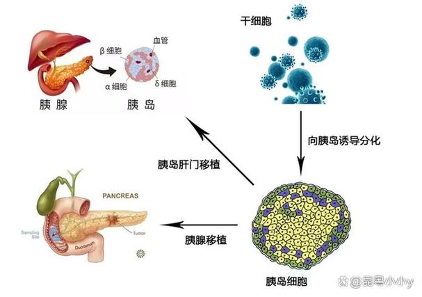 细胞控糖疗法真的假的