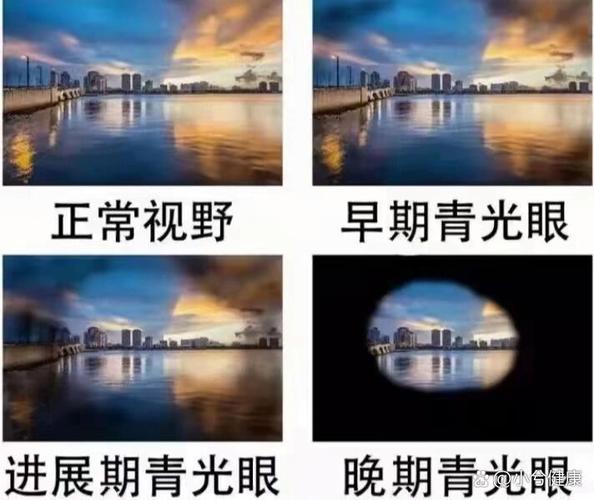 视野缺损自己能感觉到么