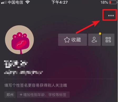 抖音开橱窗图标