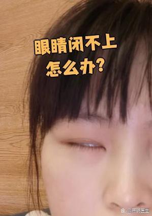 拍照眼睛闭了怎么修