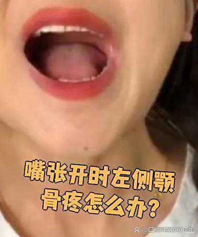 颌骨疼张嘴就疼怎么办