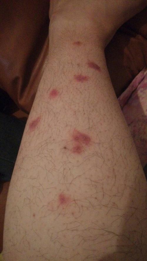 腿上两边对称红包