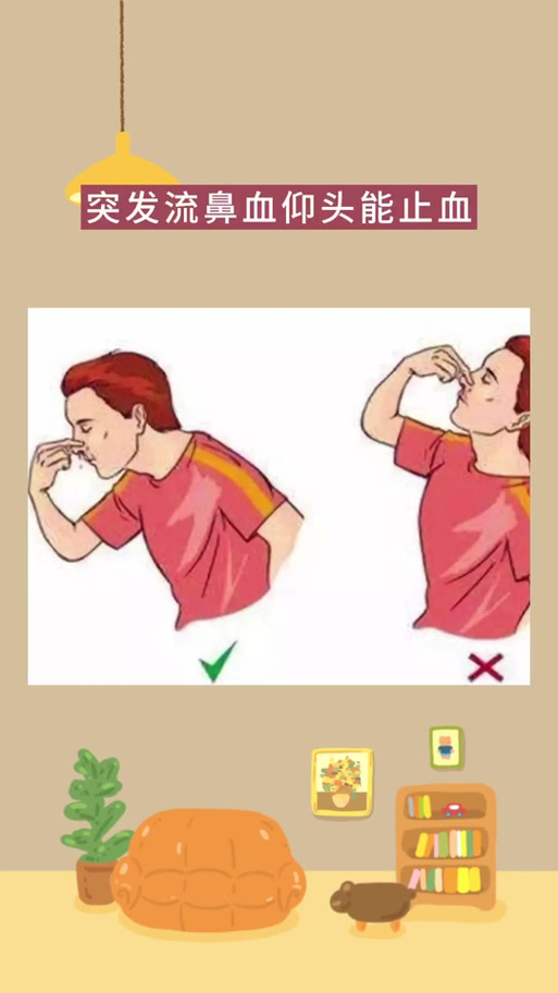 流鼻血仰头正确吗