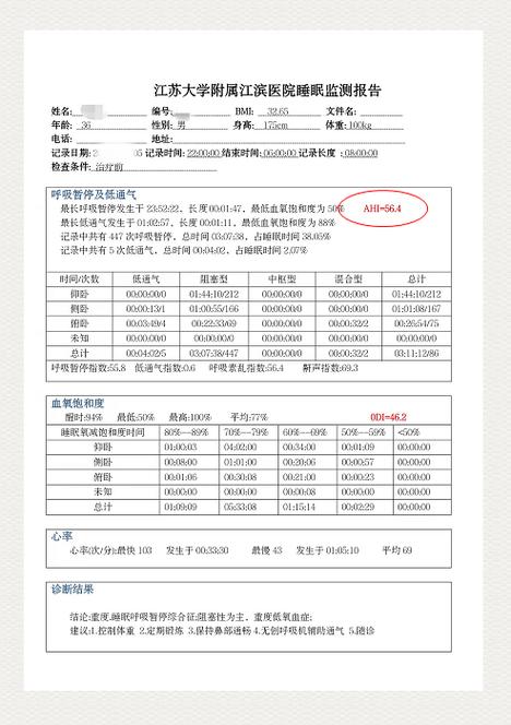 睡眠呼吸暂停监测结果