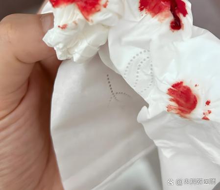 艾滋病早期流鼻血特点