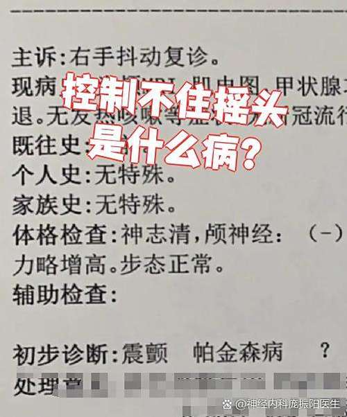 玩游戏摇头是什么原因
