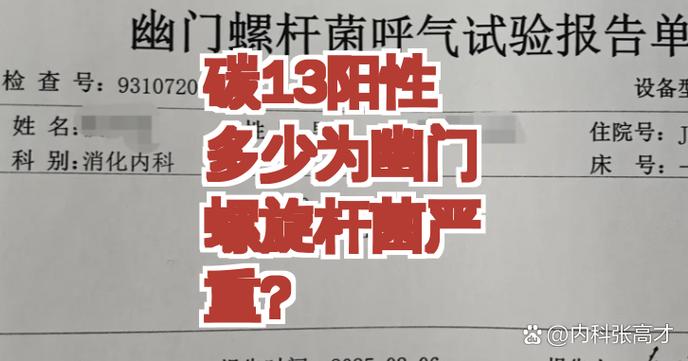 13碳检测幽门螺杆菌怎么检查