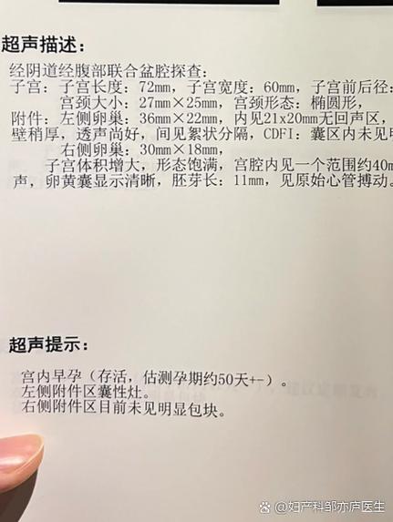 50天只有暗区没有孕囊