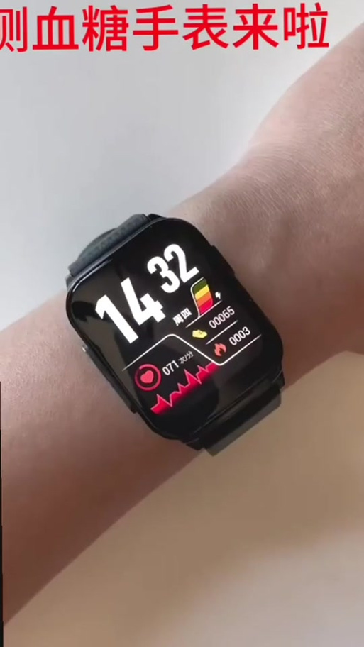 小米手环测血糖准吗截图3