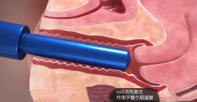 下面变黑了怎么变回粉色