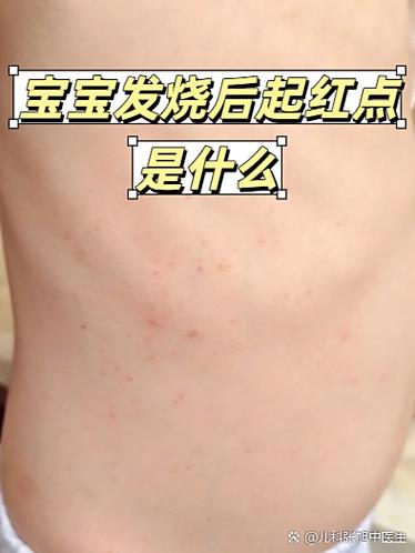 皮下有红点是什么原因