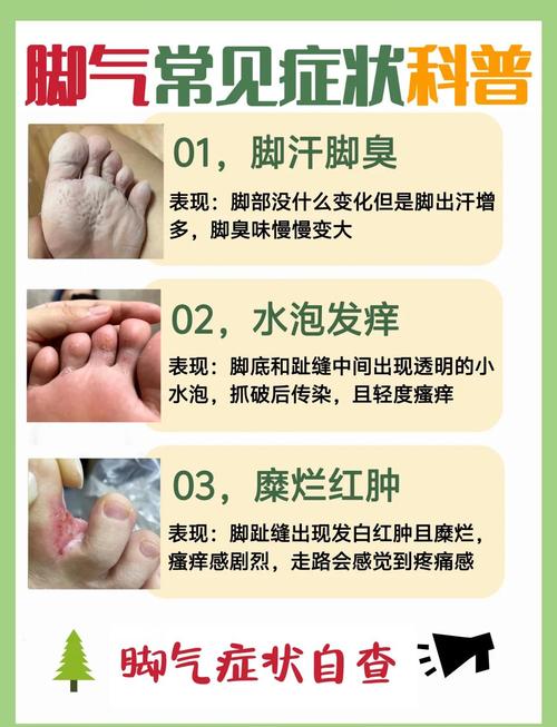 脚气真菌根治实用方法