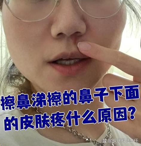 鼻子下面一滴是什么表情