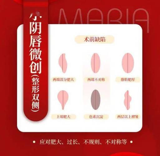 女性大阴囊唇松弛怎么办