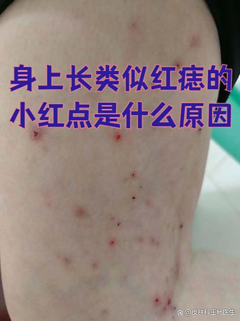 全身长小红点不疼不痒是什么原因