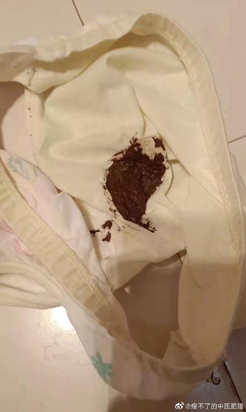 大便拉在内裤里