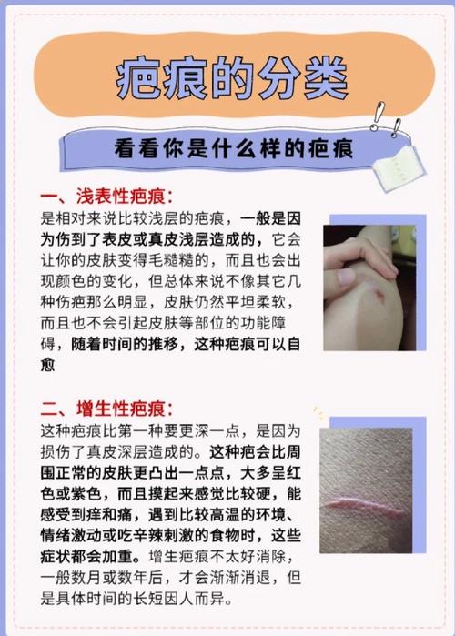 色素缺失的白色疤痕怎么去除