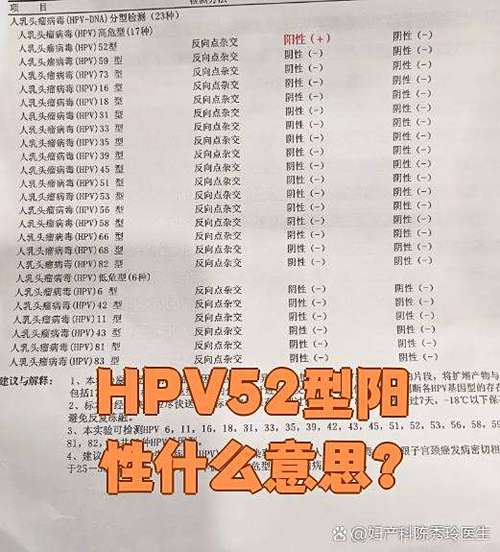 52hpv是高危还是低危