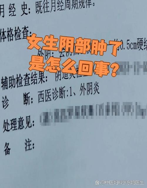 私处右侧半个肿大是什么原因