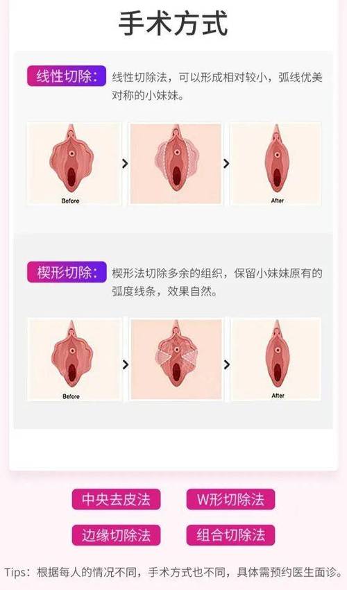 私处右侧半个肿大是什么原因截图3