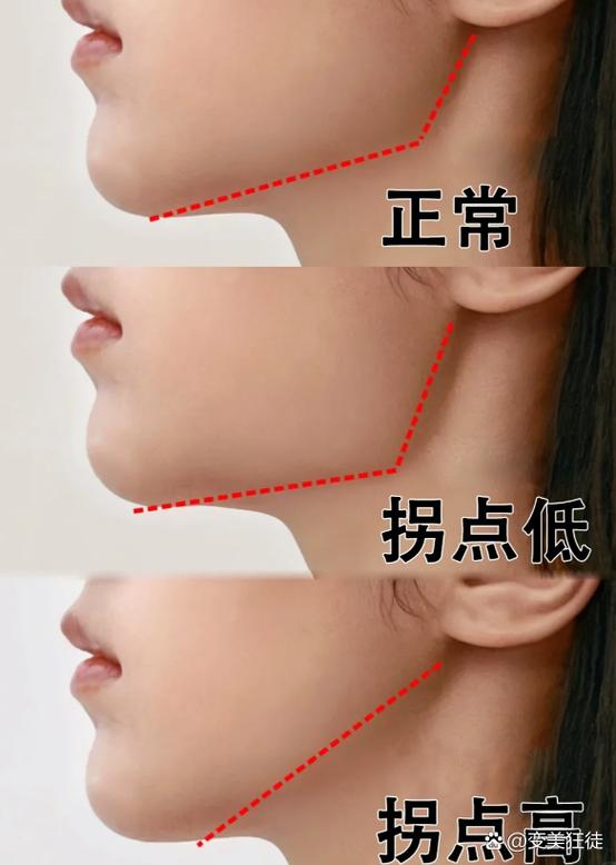 正常的脸型侧面图片