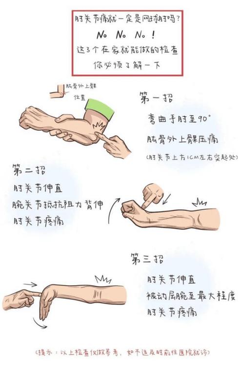 手肘疼痛位置图解