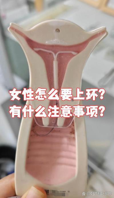 60岁取环能顺利正常取出来吗