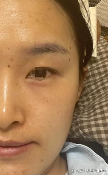 脸上暗黄发黑怎么回事儿