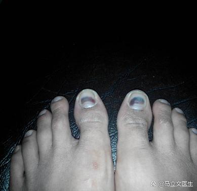 p30底色突然变成黑色