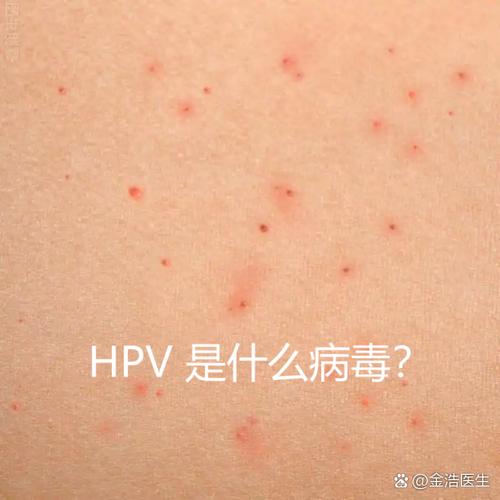 性传染的病毒有哪几种
