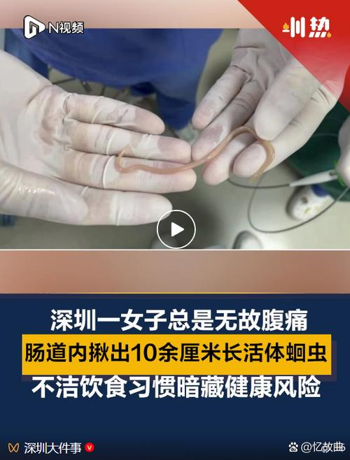 体内寄生虫怎么查出来 体内寄生虫怎么查出来