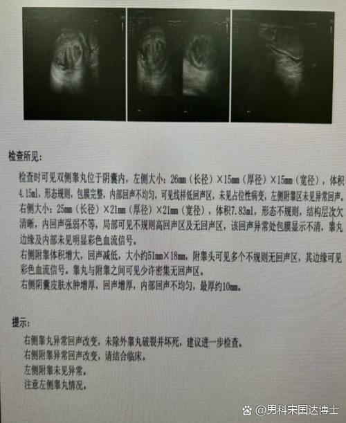 睾丸勒坏