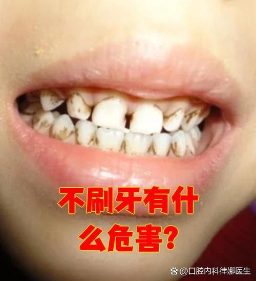 不刷牙影响做碳13吗