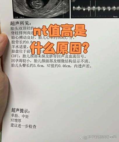 nt正常nf通过率高吗