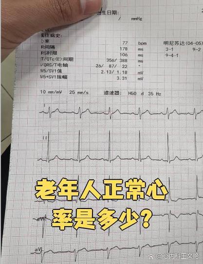 静息心率多少为正常