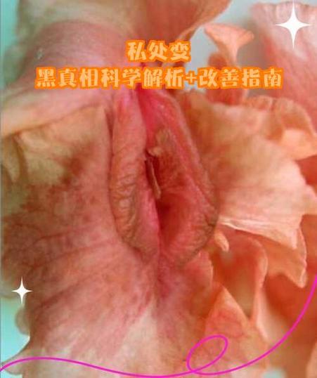 私处长了小肉粒怎么回事