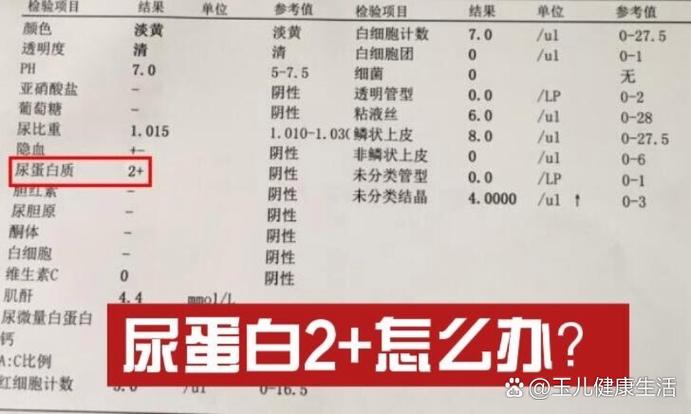 尿白细胞2个加号是什么意思