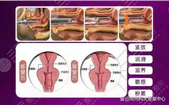 做紧缩手术在哪里做截图3