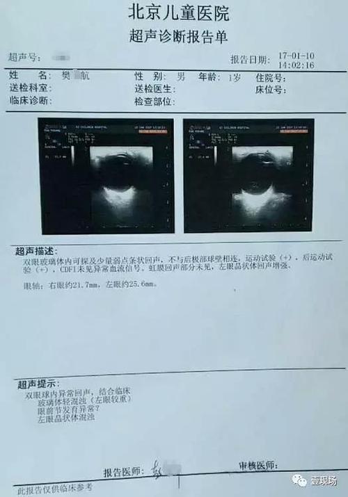 苹果打电话听到自己的回音