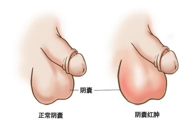 男生睾丸长什么样子的