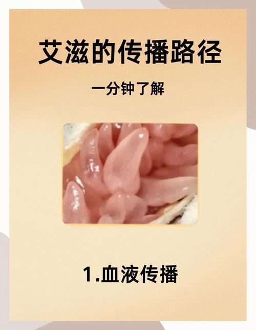 艾滋病毒最初的来源