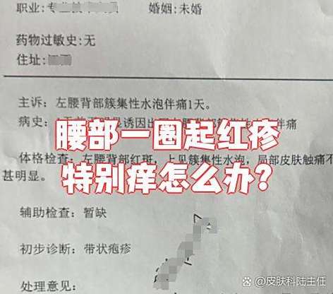 腰部特别怕痒怎么回事
